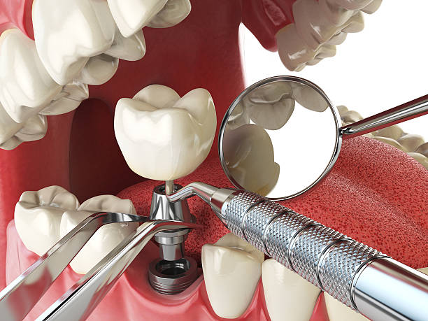 Best Emergency Dental Surgery in Mountain Road, VA